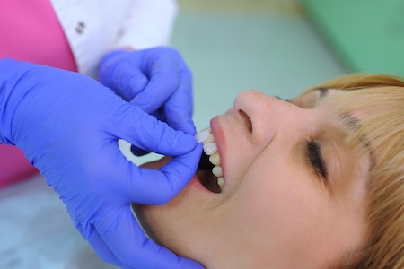 woman being fitted for veneers